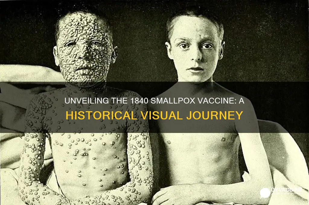 what did a smallpox vaccine look like in 1840