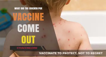When Did the Chickenpox Vaccine Arrive? A Historical Overview