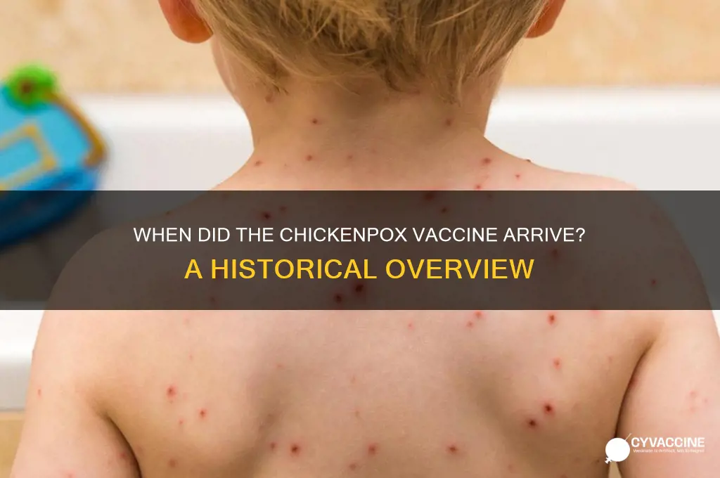 what did the chicken pox vaccine come out
