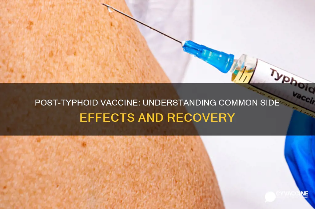 what do you feel like after typhoid vaccine