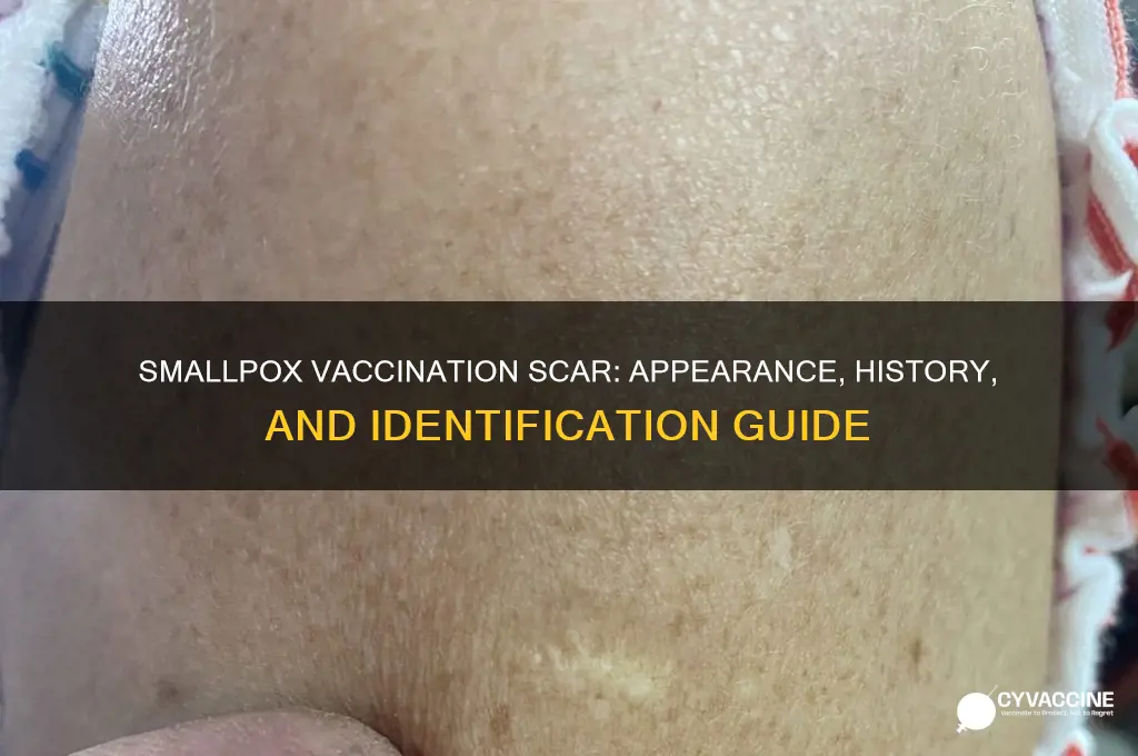 what does a smallpox vaccination scar look like