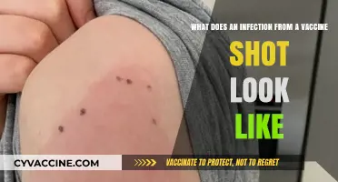 Recognizing Vaccine Shot Infections: Symptoms, Appearance, and When to Seek Help