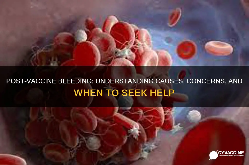 what does it mean if you bleed after a vaccine