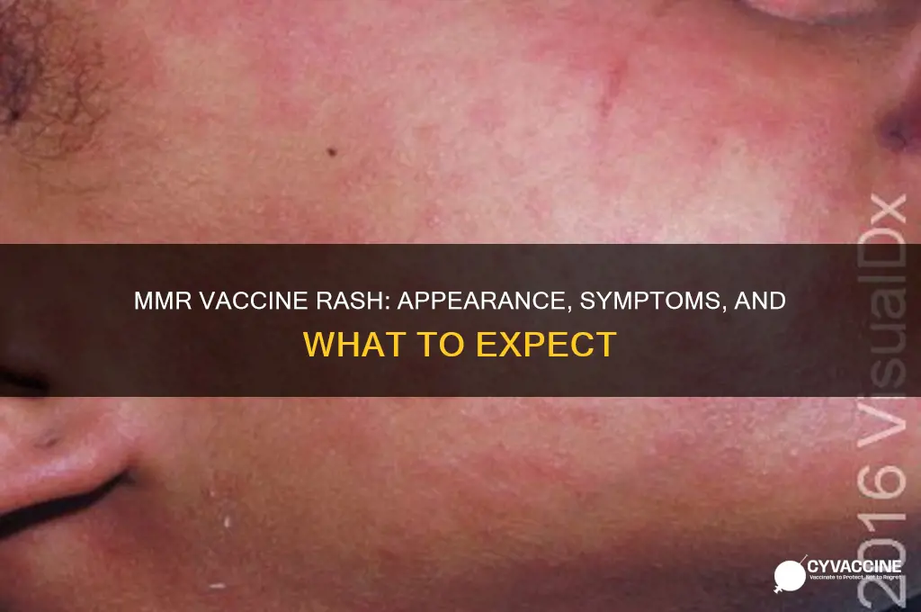 what does rash after mmr vaccine look like