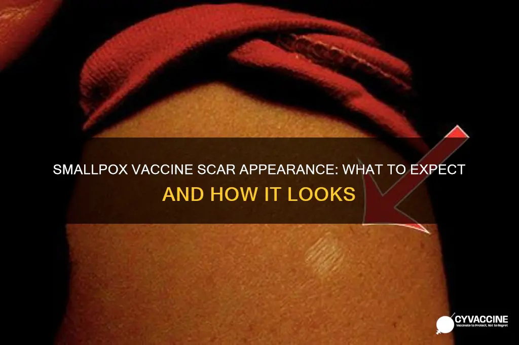 what does small pox vaccine scar look like