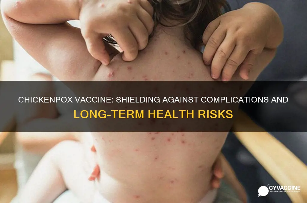 what does the chickenpox vaccine protect you from
