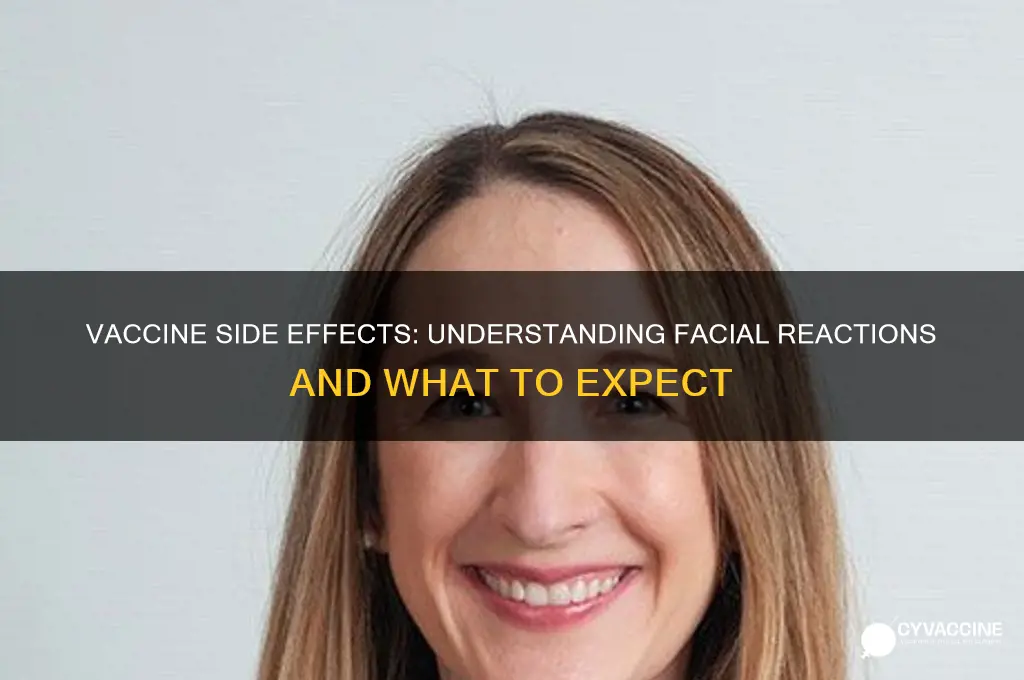 what does the vaccine do to your face