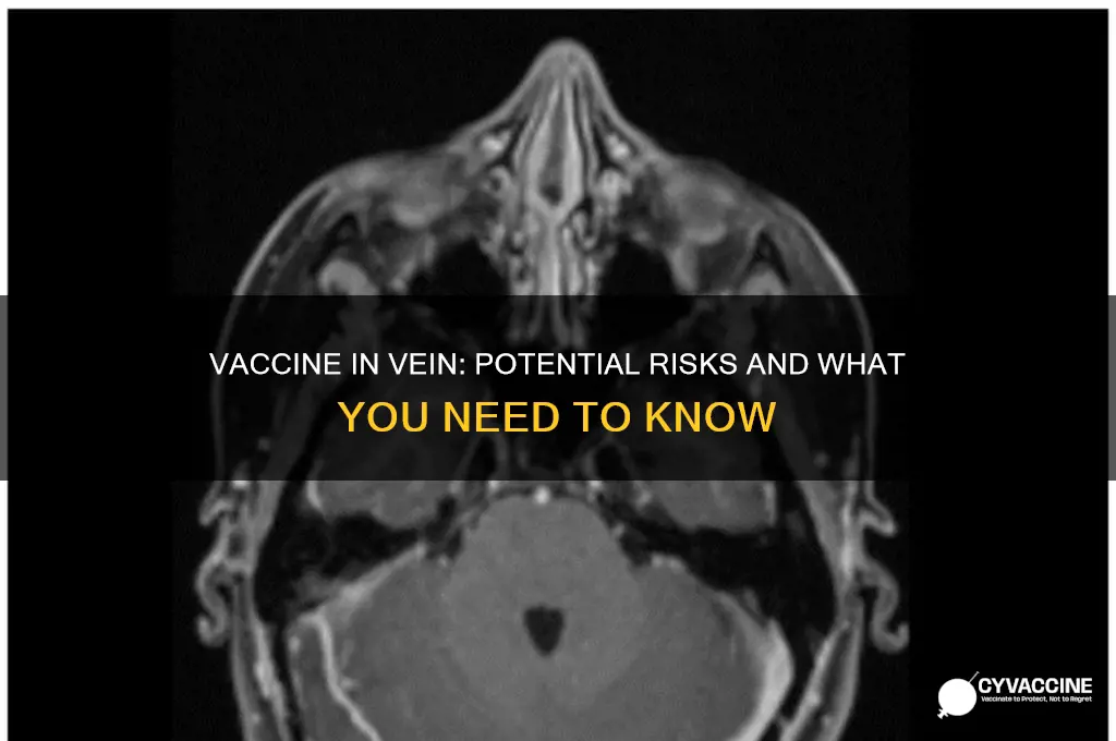 what happens if a vaccine hits a vein