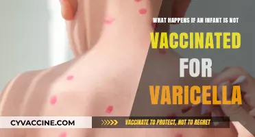 Skipping Varicella Vaccination: Risks and Consequences for Infants Explained