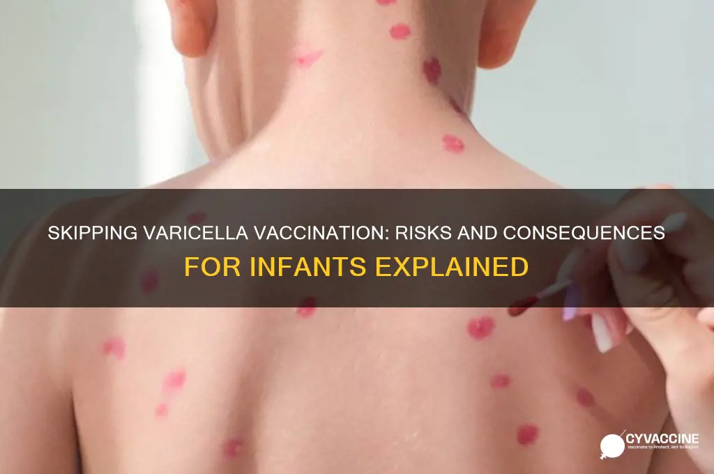 what happens if an infant is not vaccinated for varicella