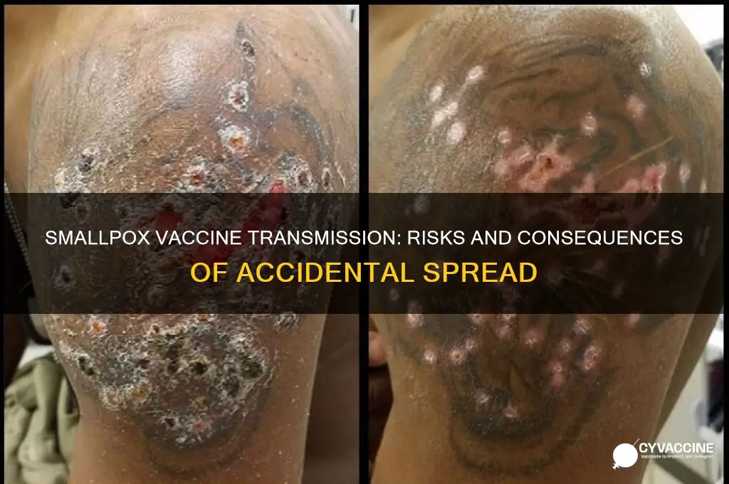 what happens if the smallpox vaccine spreads to another person
