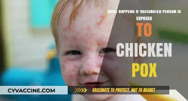 Vaccinated and Exposed: Understanding Chickenpox Risks Post-Vaccination