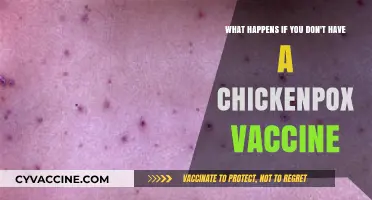 Skipping the Chickenpox Vaccine: Risks, Complications, and Long-Term Effects