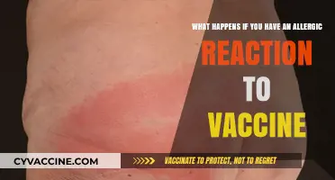 Understanding Allergic Reactions to Vaccines: Symptoms, Risks, and Immediate Actions