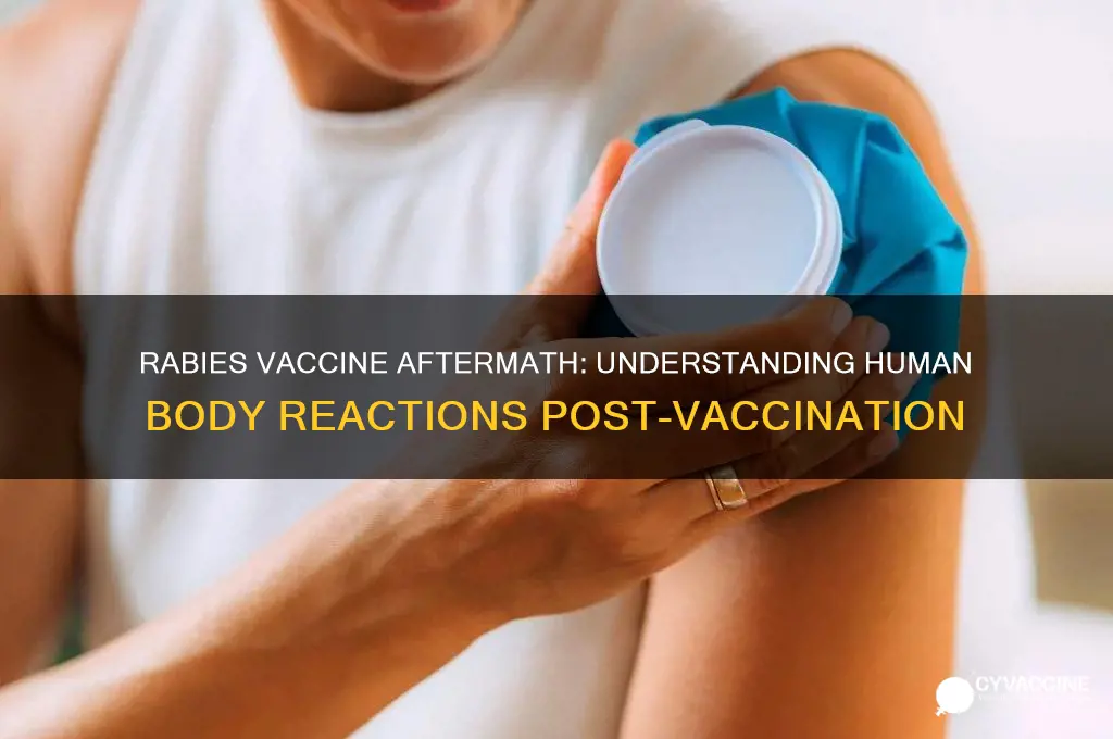 what happens to a human after a rabies vaccine