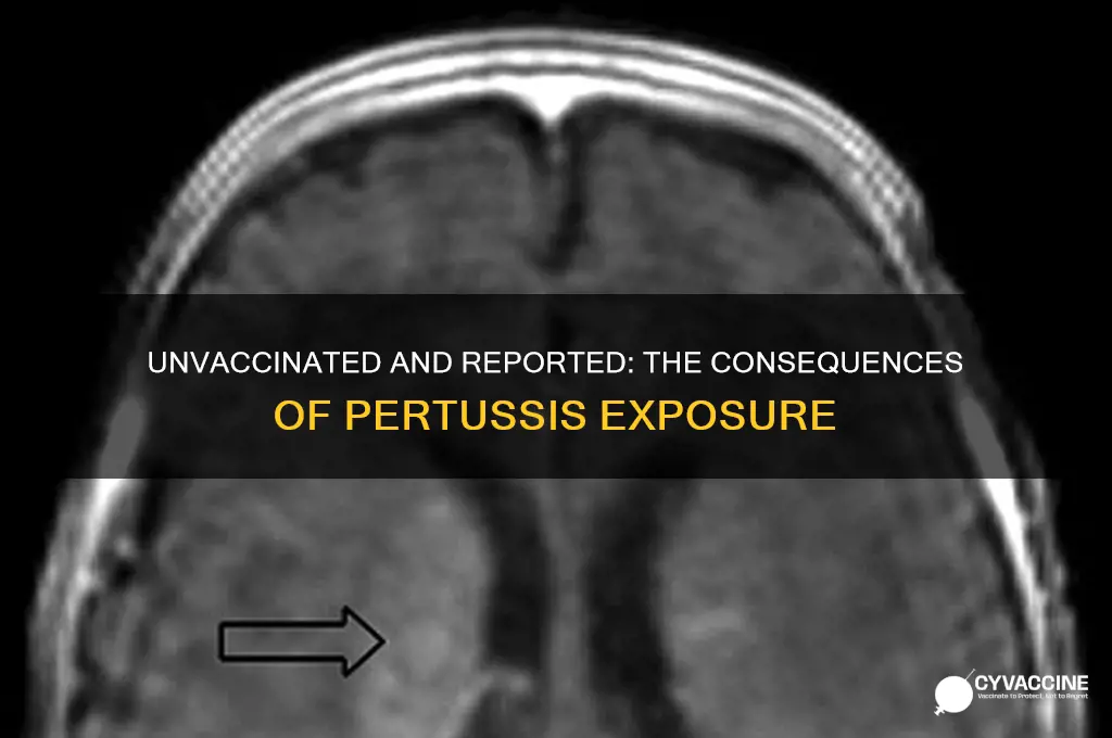 what happens when a doctor reported pertussis no vaccination