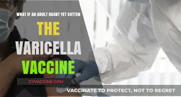 Adult Without Varicella Vaccine: Risks, Benefits, and Next Steps