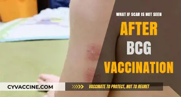 BCG Vaccination Without a Scar: Causes and Concerns Explained