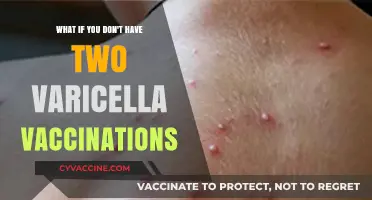 Skipping Second Varicella Shot: Risks, Complications, and Prevention Strategies