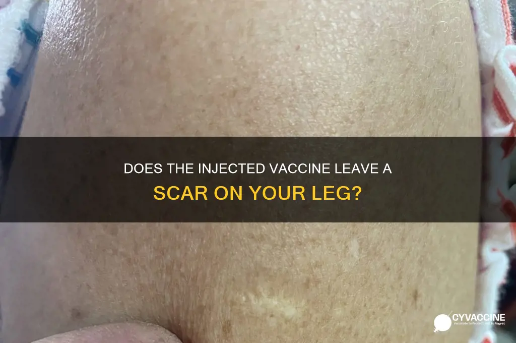 what injected vaccine leaves a scaron your leg