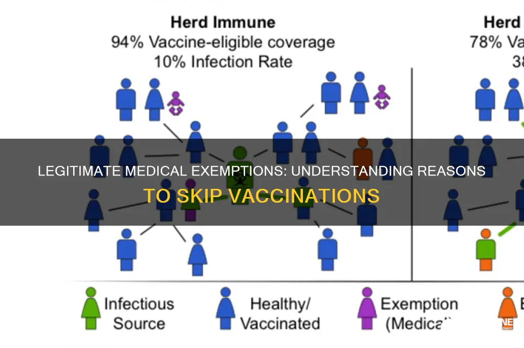 what is a legitimate medical reason to not be vaccinated