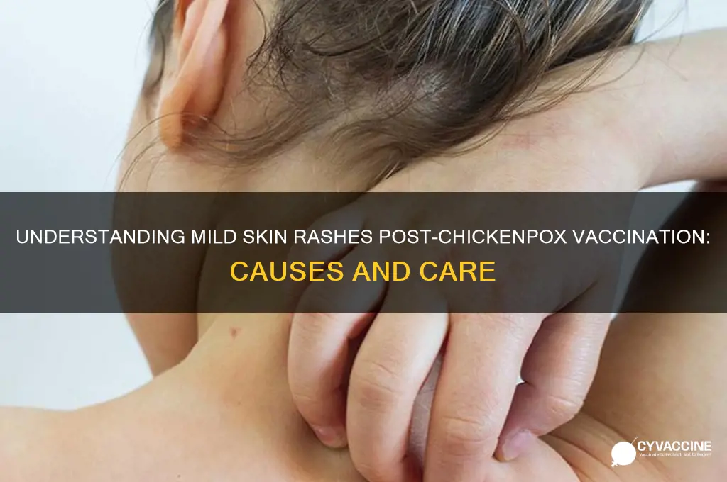 what is a mild skin rash from chicken pox vaccine