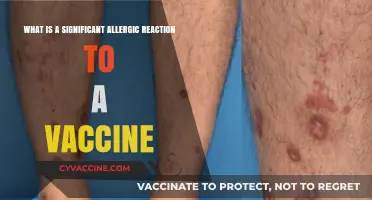 Understanding Severe Allergic Reactions to Vaccines: Symptoms and Immediate Care