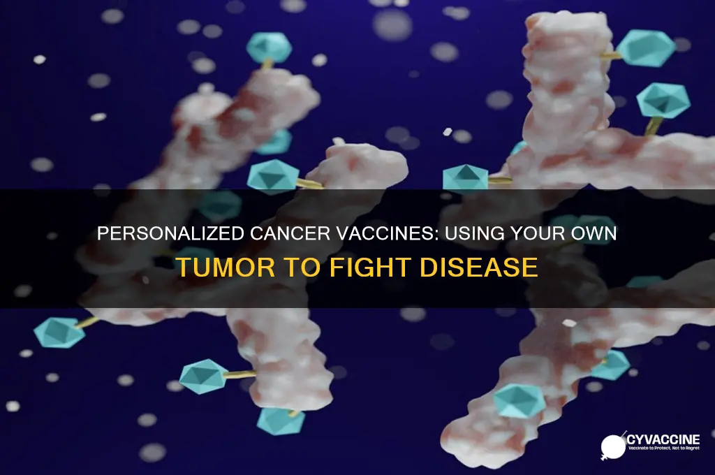 what is called vaccine that made of person own tumor