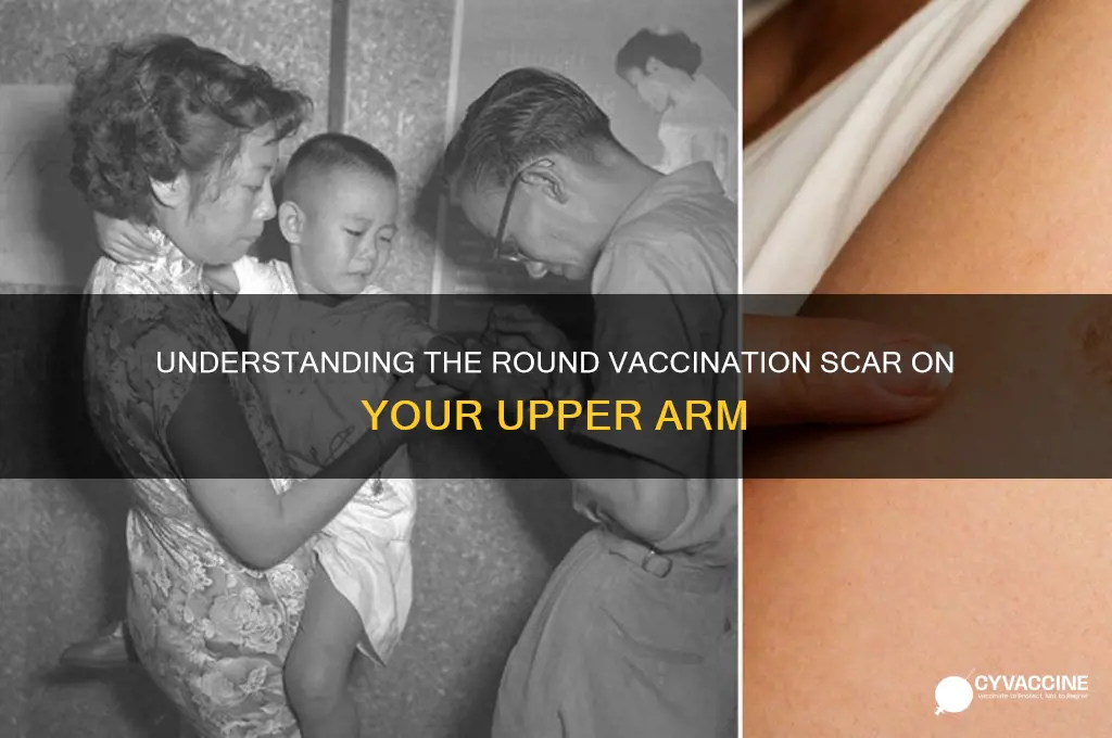 what is round vaccination scar on upper arm