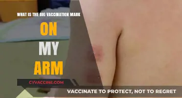 Understanding the Circular Vaccination Mark on Your Arm: Causes and Care