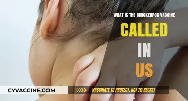 Understanding the Chickenpox Vaccine Name in the United States