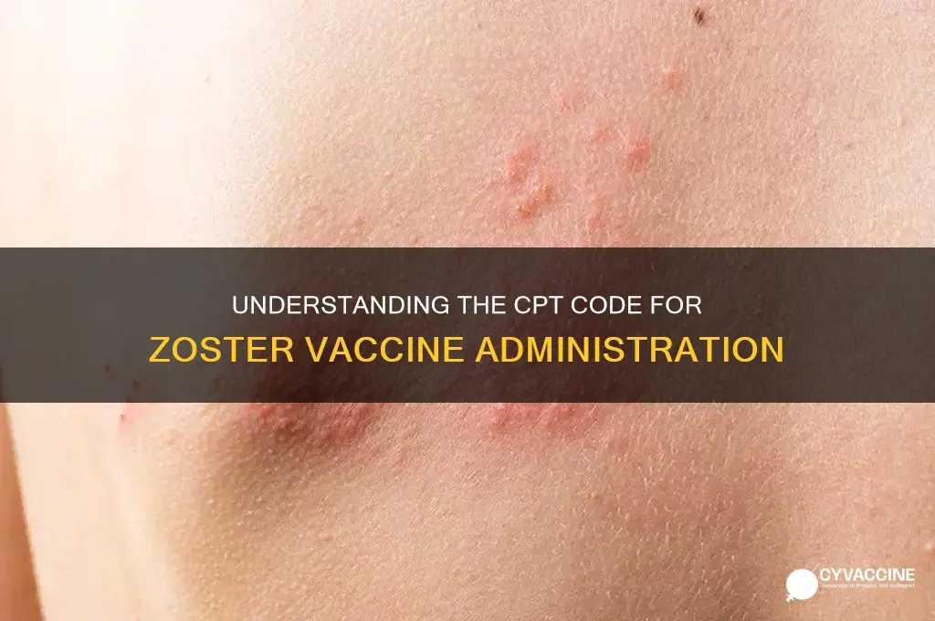 what is the cpt code for zoster vaccine
