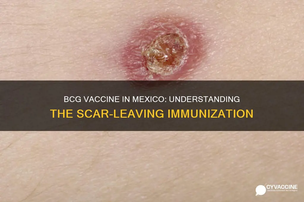 what is the mexican vaccine that leaves a scar