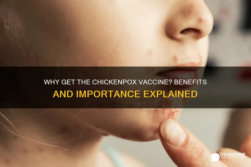 what is the point of the chickenpox vaccine