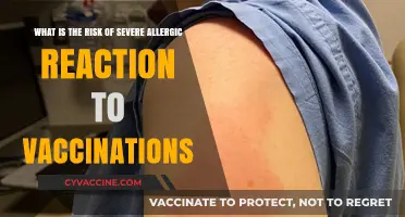 Understanding Severe Allergic Reactions: Vaccination Risks and Safety Measures