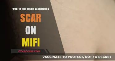 Understanding the Round Vaccination Scar on Mifi: Causes and Insights