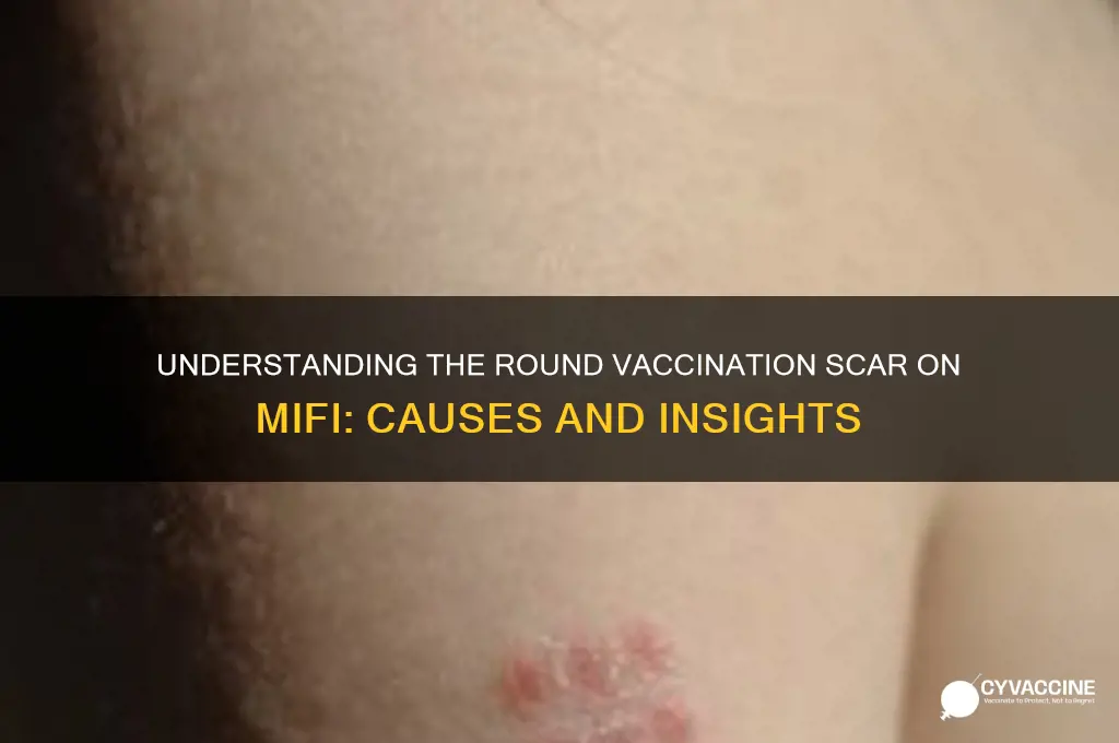 what is the round vaccination scar on mifi