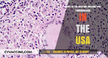 Understanding the Standard Tuberculosis Vaccination Protocol in the United States