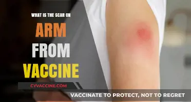 Understanding the Arm Scar: Vaccine Side Effects Explained