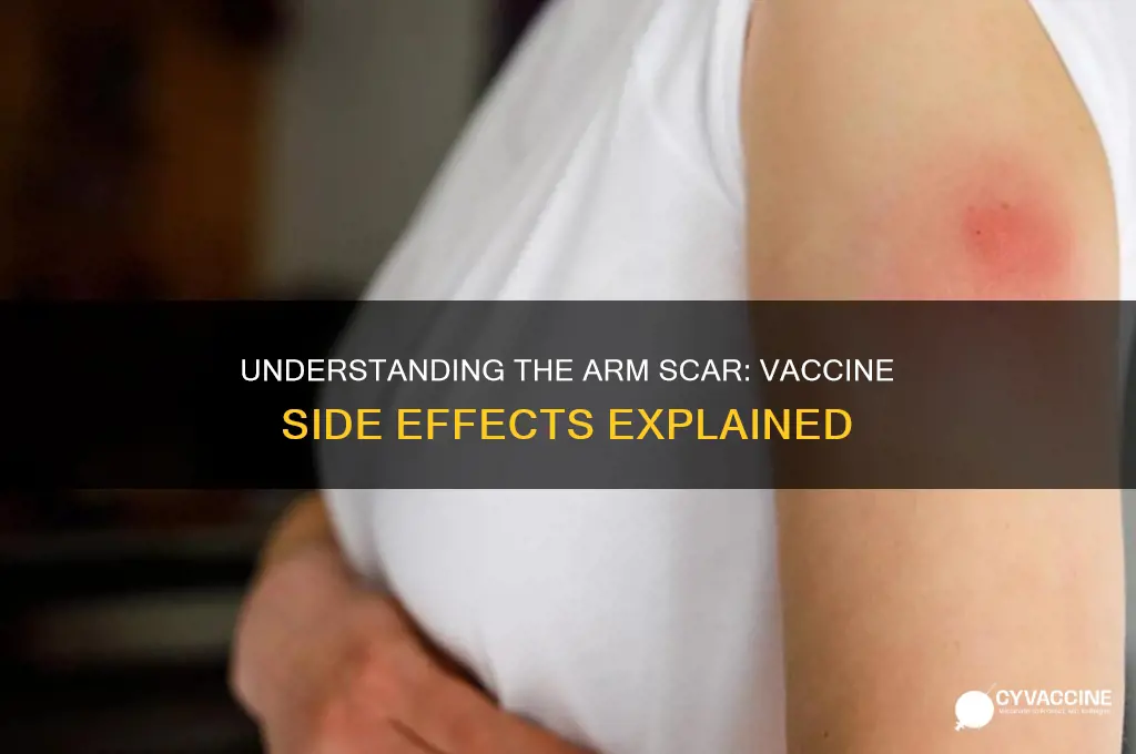 what is the scar on arm from vaccine