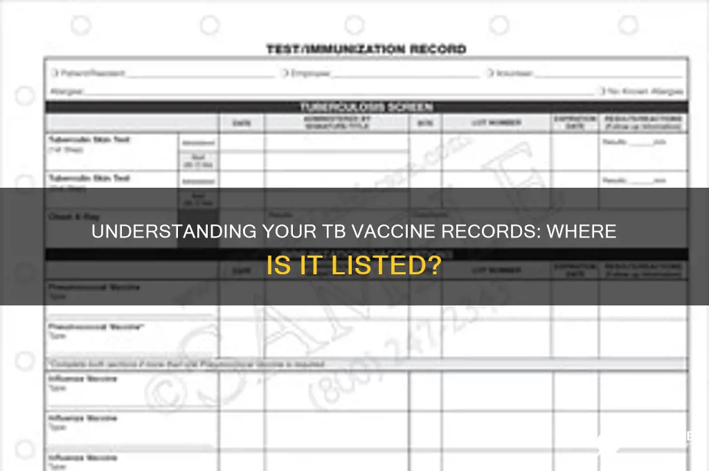 what is the tb vaccine listed under in your records