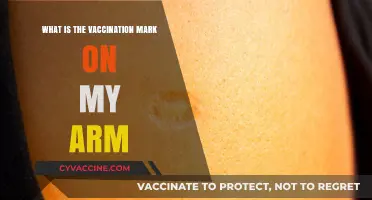 Vaccination Marks: What's That Spot on My Arm?