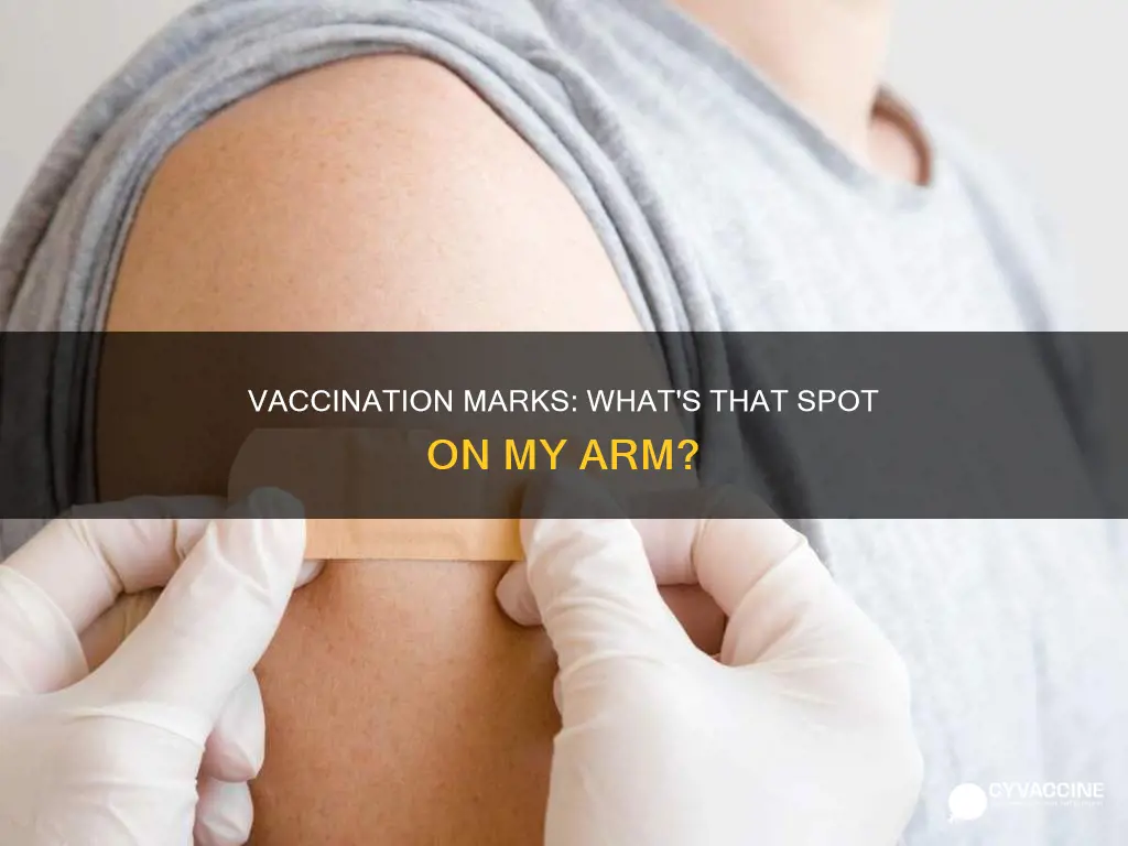 what is the vaccination mark on my arm