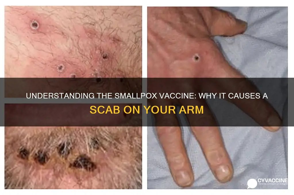 what is the vaccination that caise a scab on arm