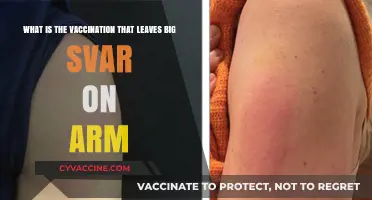 Understanding the COVID-19 Vaccine's Notable Arm Swelling Side Effect
