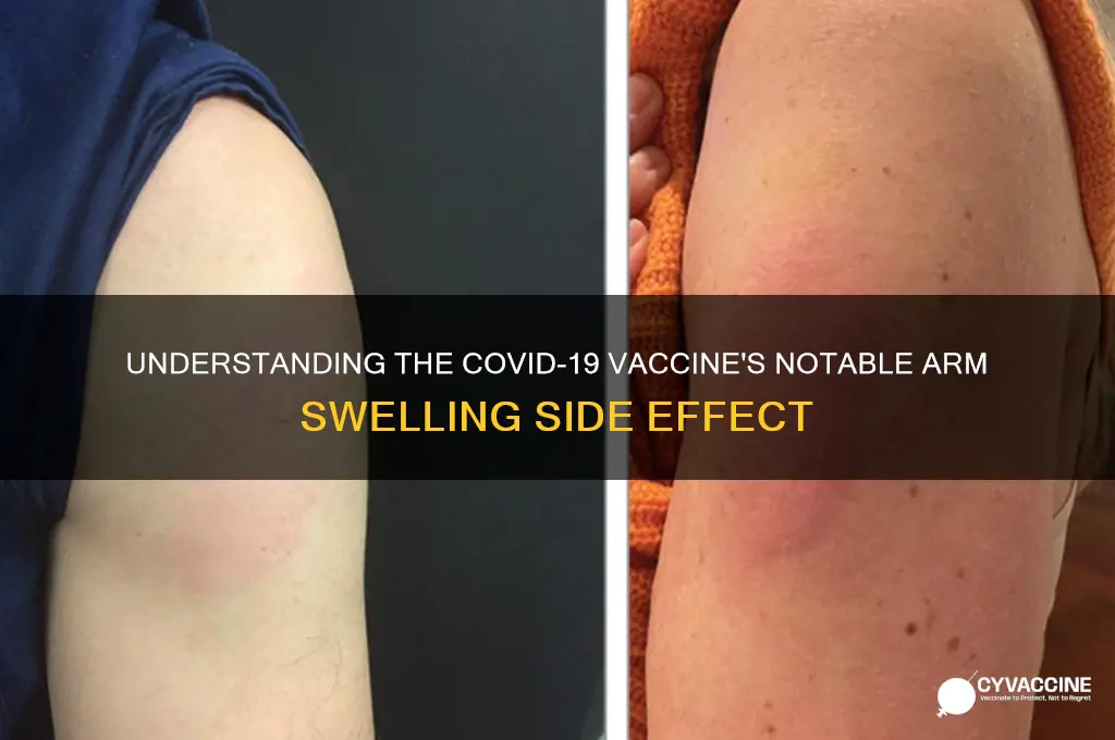 what is the vaccination that leaves big svar on arm