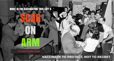 Vaccination Scars: What's the Story Behind the Mark?