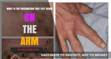 Scars on the Arm: Understanding the Smallpox Vaccine's Mark