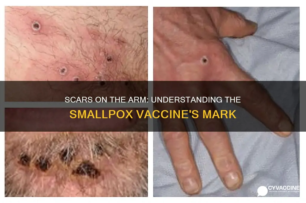 what is the vaccination that left scars on the arm