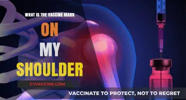 Understanding the Vaccine Mark on Your Shoulder: Causes and Concerns